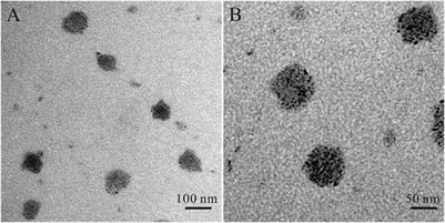 OEA loaded liposomes with the neuroprotective effect for stroke therapy